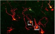 Neural repair: from mechanisms of direct reprogramming to functional integration